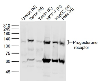 Phospho-Progesterone Receptor (Ser190) Rabbit Polyclonal Antibody