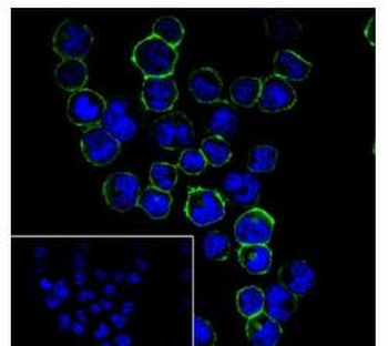 CD38 Recombinant Rabbit Monoclonal Antibody
