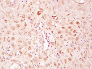 Phospho-SMAD2 (Ser464) Rabbit Polyclonal Antibody