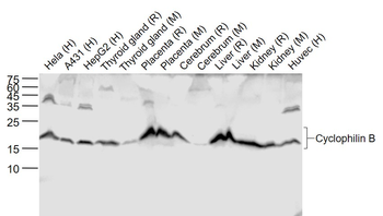Cyclophilin B Recombinant Rabbit Monoclonal Antibody (Loading Control)