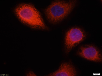 CK18 Mouse Monoclonal Antibody