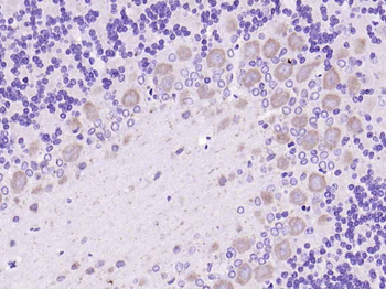 ADORA2B Rabbit Polyclonal Antibody