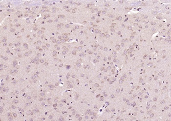 RNF43 antibody
