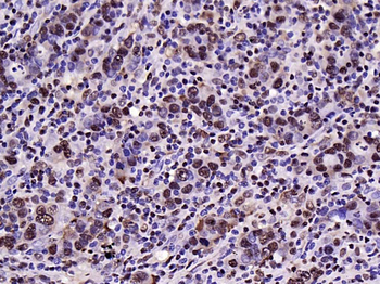 HMGB1 Rabbit Polyclonal Antibody