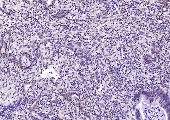 Ubiquitin Mouse Monoclonal Antibody