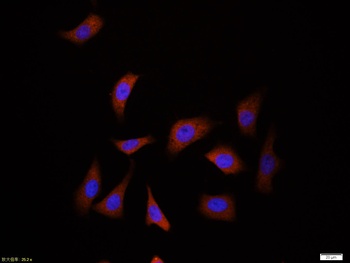Ubiquitin antibody