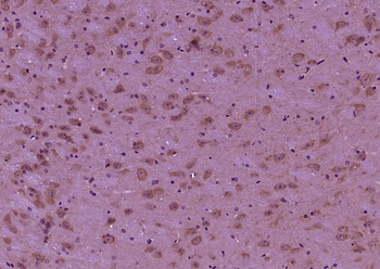 Phospho-Tau (Ser396) Rabbit Polyclonal Antibody