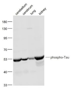 Phospho-Tau (Ser422) Rabbit Polyclonal Antibody