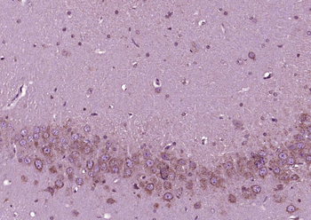 Phospho-Tau (Ser262) Rabbit Polyclonal Antibody