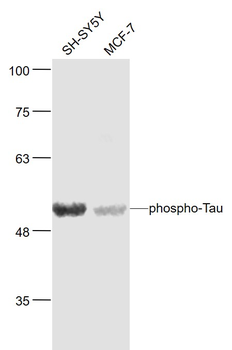 Phospho-Tau (Ser404) Rabbit Polyclonal Antibody