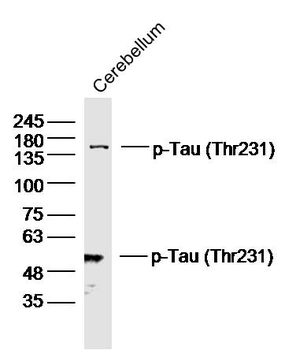 Phospho-Tau (Thr231) Rabbit Polyclonal Antibody