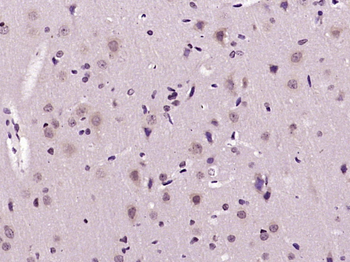 Phospho-Tau (Ser199) Rabbit Polyclonal Antibody