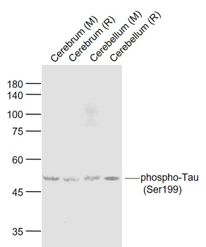 Phospho-Tau (Ser199) Rabbit Polyclonal Antibody