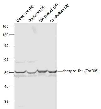 Phospho-Tau (Thr205) Rabbit Polyclonal Antibody
