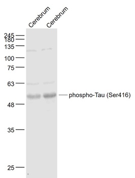Tau protein (phospho-Ser416) antibody
