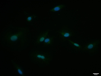 TRIM28 Rabbit Polyclonal Antibody
