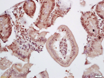 TIF1 gamma Rabbit Polyclonal Antibody