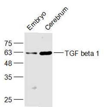 TGF beta 1 Rabbit Polyclonal Antibody