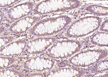 PRAK Rabbit Polyclonal Antibody