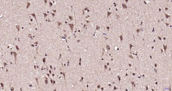 Phospho-MAPKAPK5 (Thr182) Rabbit Polyclonal Antibody