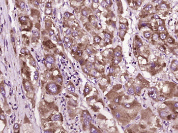 TMEFF2 Rabbit Polyclonal Antibody