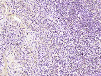 Phospho-TOP2A (Ser1106) Rabbit Polyclonal Antibody