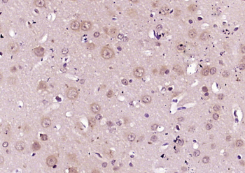 Phospho-TPH (Ser260) Rabbit Polyclonal Antibody