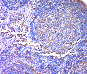 TREML1 Rabbit Polyclonal Antibody