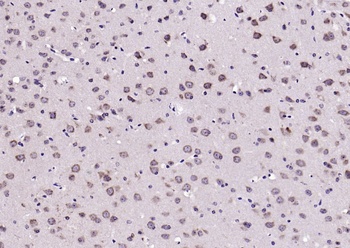 TrkB (phospho-Tyr515) antibody