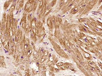 THBS1 Rabbit Polyclonal Antibody