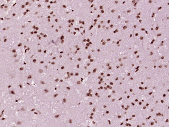 Phospho-TH (Ser31) Rabbit Polyclonal Antibody