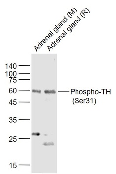 Tyrosine Hydroxylase (phospho-Ser31) antibody