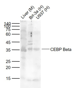 CEBP Beta Rabbit Polyclonal Antibody