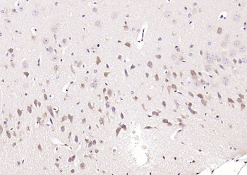 APG4B (Acetyl K39) Rabbit Polyclonal Antibody