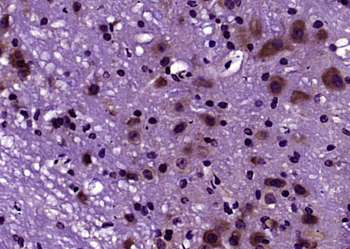 DNase II Rabbit Polyclonal Antibody