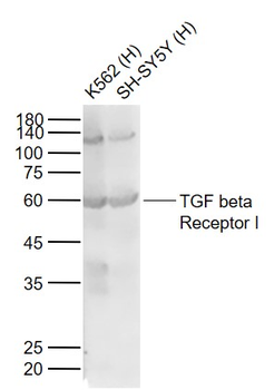 TGF beta Receptor I Rabbit Polyclonal Antibody
