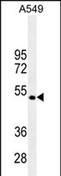 TGF beta 2 Mouse Monoclonal Antibody