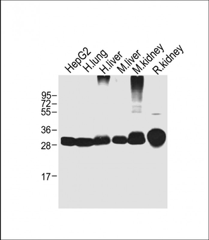 SULT1A1 Mouse Monoclonal Antibody
