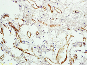 PAR4 Rabbit Polyclonal Antibody