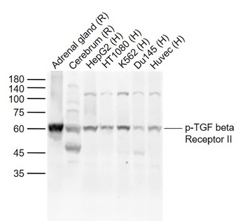 TGF Beta Receptor II (phospho-Ser225) antibody