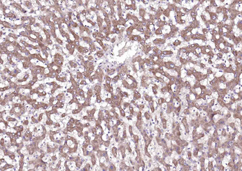 VEGF165 Mouse Monoclonal Antibody