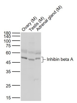 Inhibin Beta A antibody