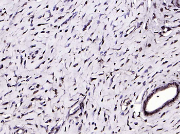 NOBOX Rabbit Polyclonal Antibody