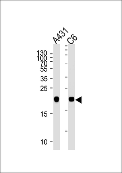 NRAS Mouse Monoclonal Antibody