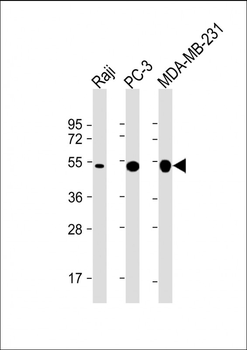MMP1 Mouse Monoclonal Antibody