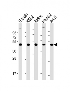TSG101 Mouse Monoclonal Antibody