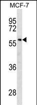 GBA Mouse Monoclonal Antibody