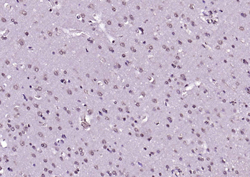 Phospho-AKT1 (Ser124) Rabbit Polyclonal Antibody