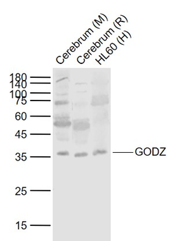ZDHHC3 Rabbit Polyclonal Antibody