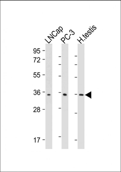 RNF4 Mouse Monoclonal Antibody